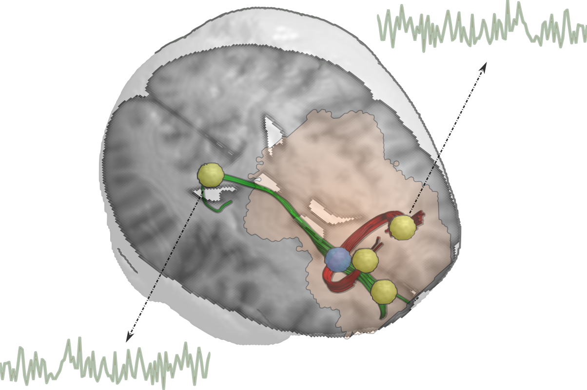 TMS-White-Matter_photo-1